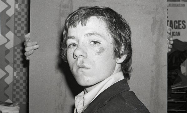 Young man injured by rubber bullet